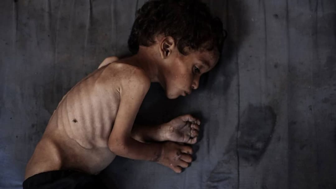 Child experiencing food insecurity